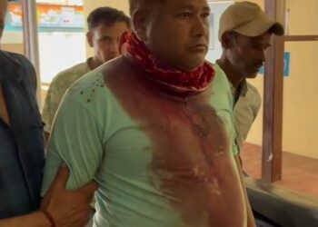 हिरमोली गांव में जंगली सुअर का हमला, एक ग्रामीण गंभीर रूप से घायल गांव में दहशत, ग्रामीणों ने वन विभाग और प्रशासन से की त्वरित कार्रवाई की मांग