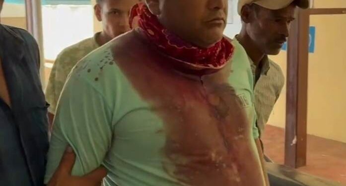 हिरमोली गांव में जंगली सुअर का हमला, एक ग्रामीण गंभीर रूप से घायल गांव में दहशत, ग्रामीणों ने वन विभाग और प्रशासन से की त्वरित कार्रवाई की मांग